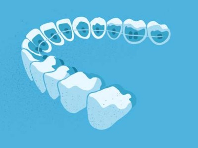 惟德口腔醫(yī)院口腔正畸好不好？