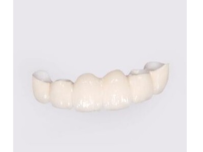 請問承德做一顆全瓷牙價(jià)位是多少